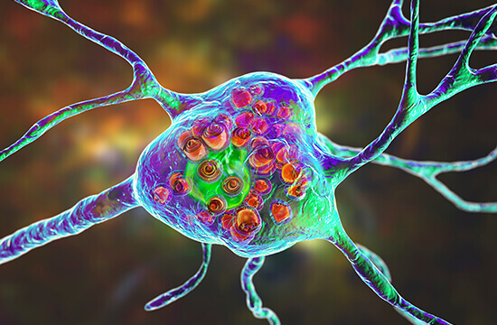 Gangliosides Analysis