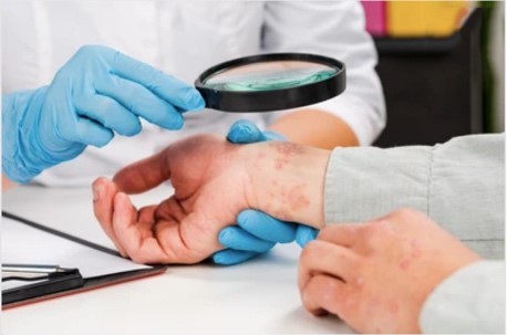Skin Diseases