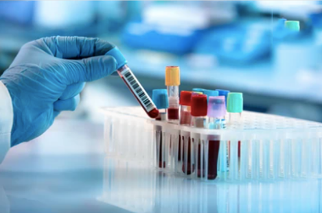 Biomarker Analysis
