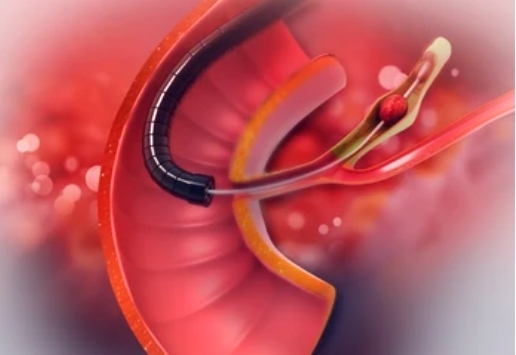 Exploring the Intricate Link Between Bile Acids and Disease
