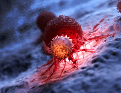 Lipidomics for Cancer Research